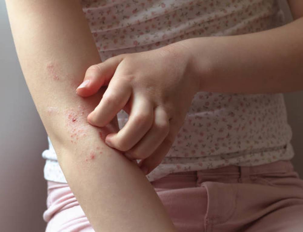 لا تتجاهلها.. أعراض لحساسية الأطفال تستوجب التدخل الطبي